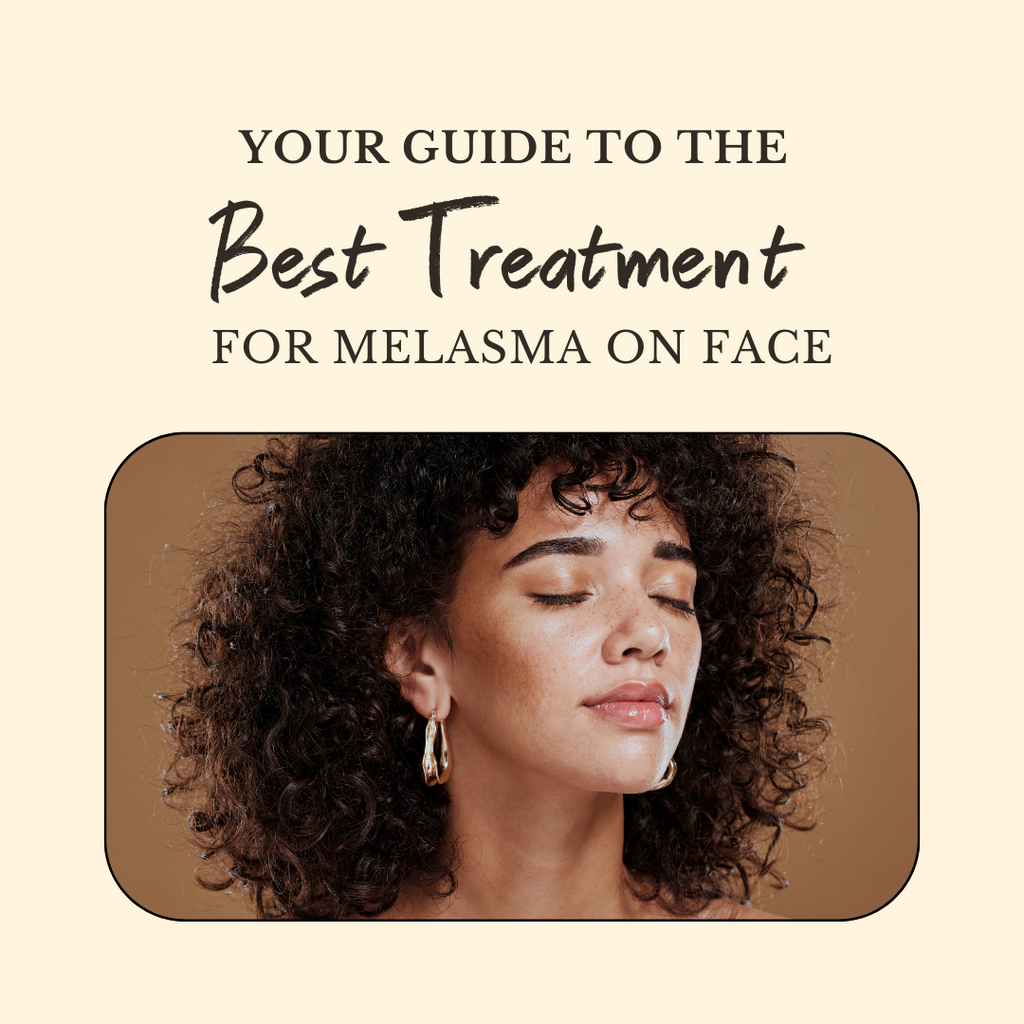 Your Guide to the Best Treatment for Melasma on Face!