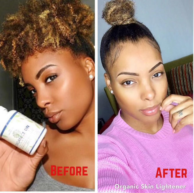 Organic Skin Lightener