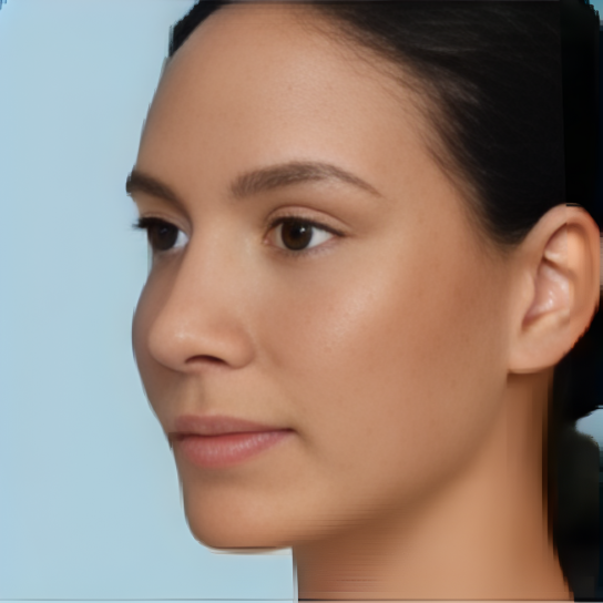 After - Customer Result A